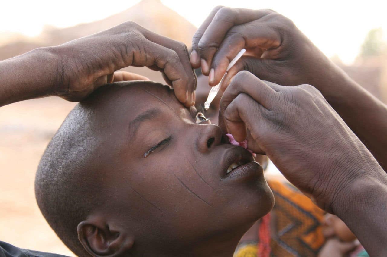 Un enfant ferme les yeux pendant qu’une personne lui instille des gouttes dans l’œil avec une pipette.